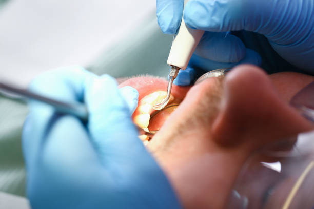 Best Urgent Care for Lost Fillings or Crowns in Millersport, OH