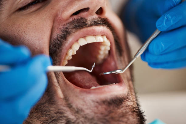 Best Same-Day Emergency Dental Services in Millersport, OH
