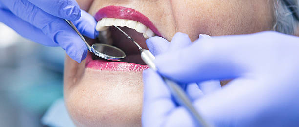 Best Emergency Root Canal Treatment in Millersport, OH
